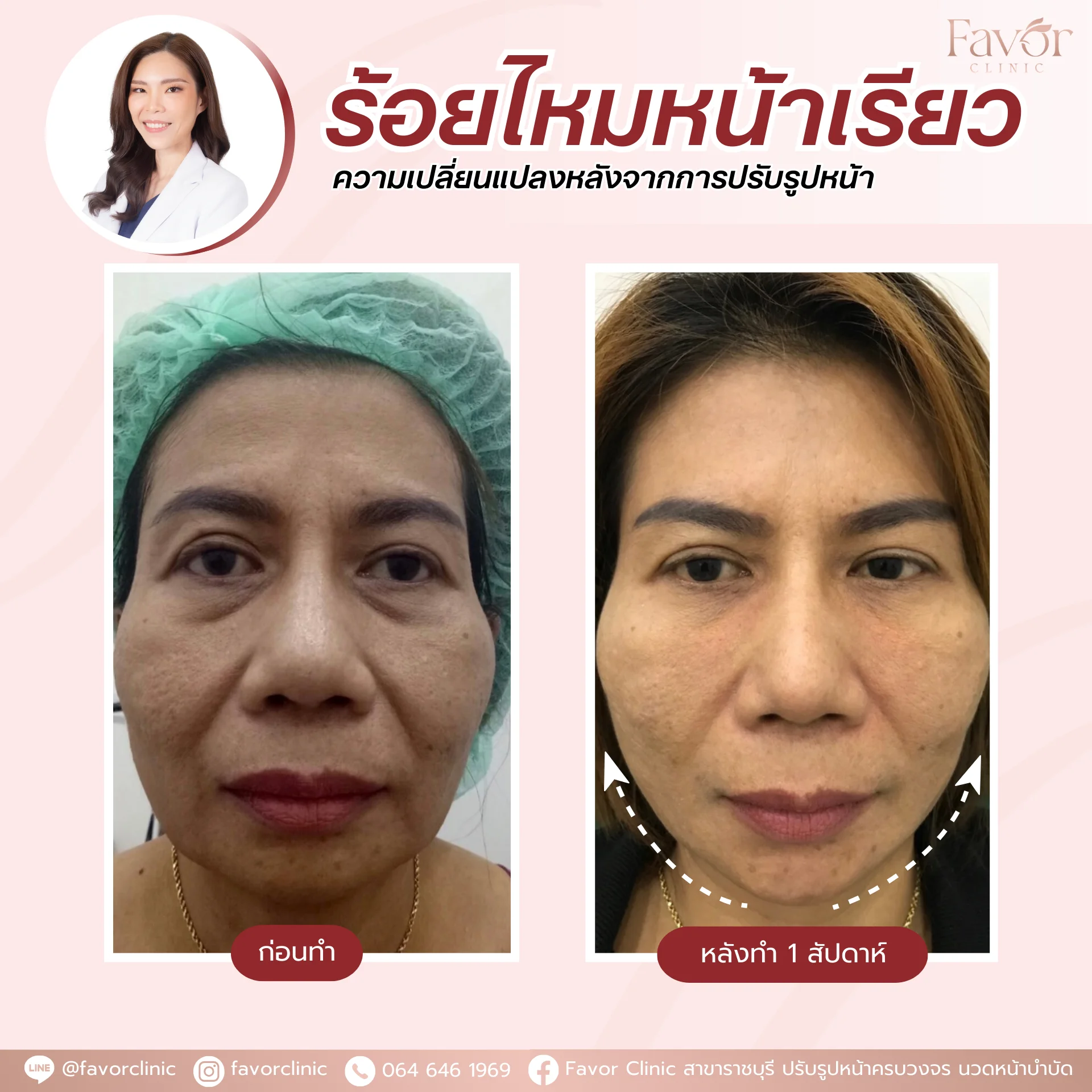 Favorclinic