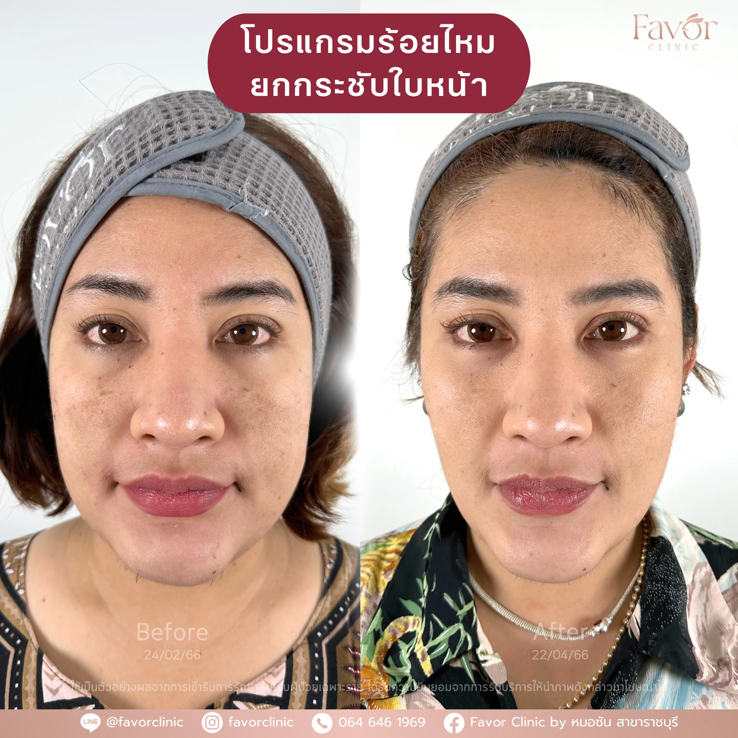 Favorclinic