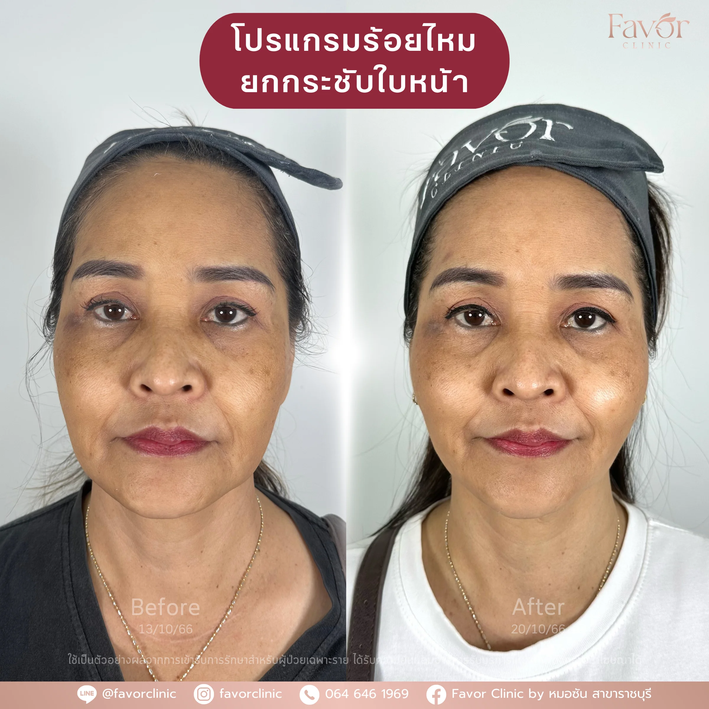 Favorclinic